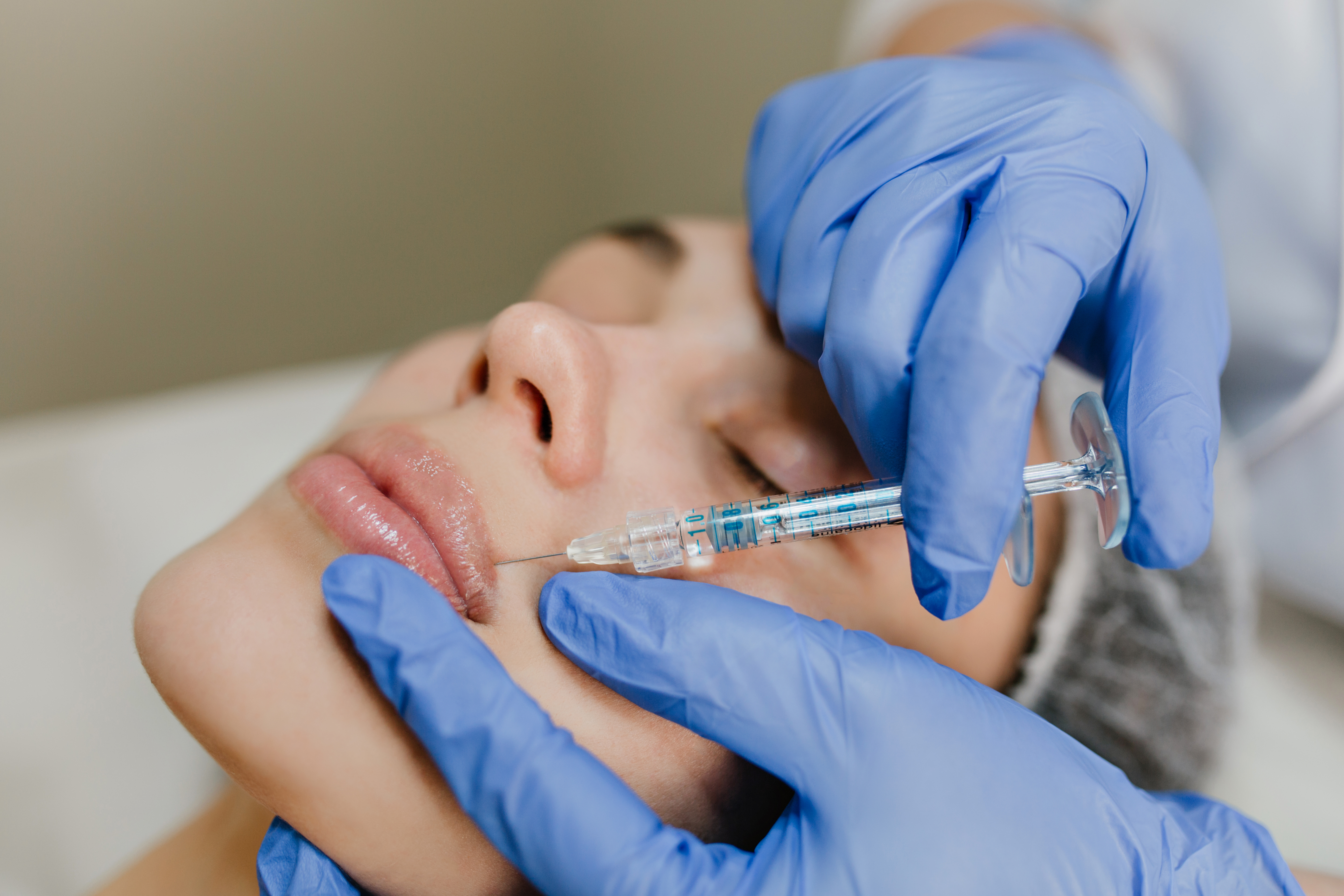 Dermal fillers treatment